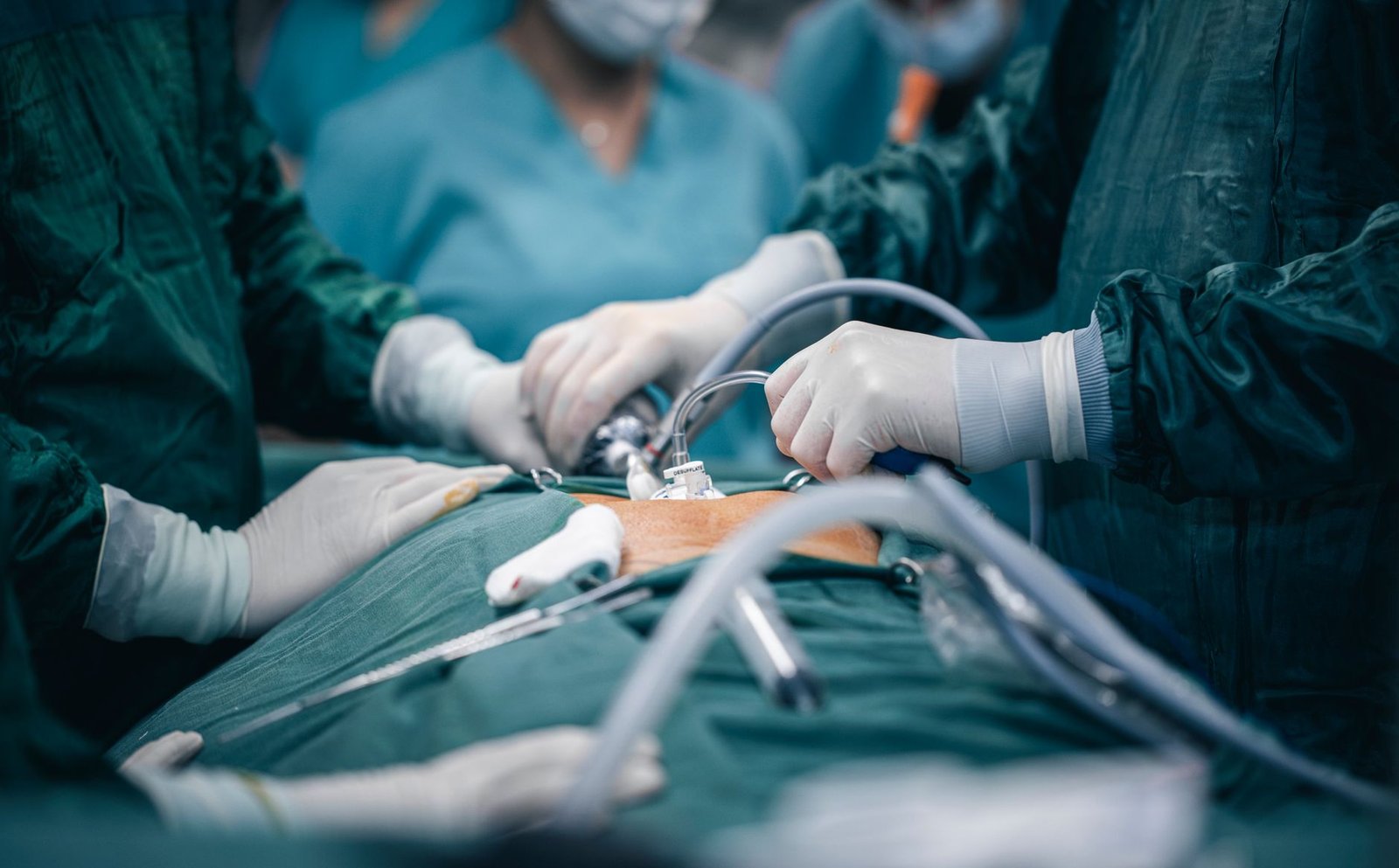Cirurgia por videolaparoscopia